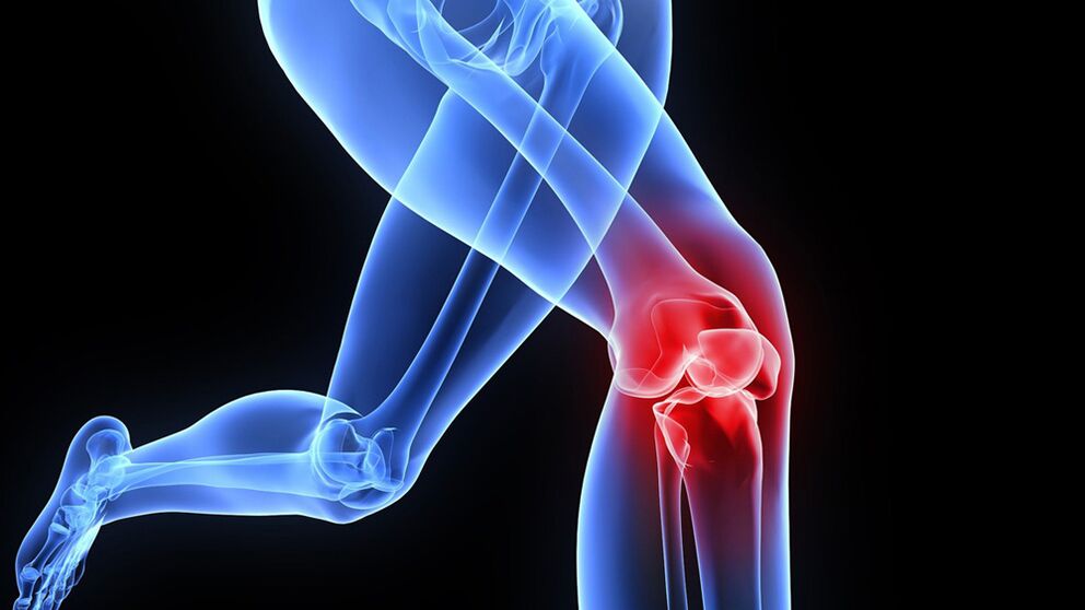 arthrosis miatti térdproblémák